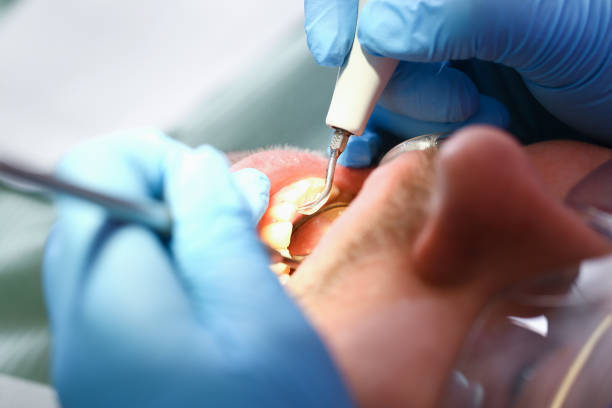 Best Emergency Treatment for Toothache in Prices Fork, VA