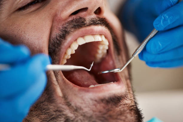 Best Emergency Broken Tooth Repair in Prices Fork, VA